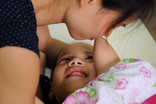 limbless, linh chi, nick, artificial limbs