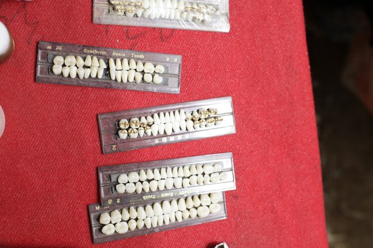 gold teeth, making new teeth, ethnic people, fairs