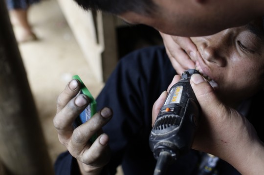 gold teeth, making new teeth, ethnic people, fairs