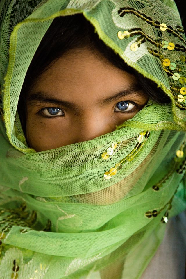 Vietnamese girl with differently colored eyes, thach thi sa pa, an phuoc, blue eyes, eyes with two colors, social news, vietnamnet bridge, english news, Vietnam news, news Vietnam, vietnamnet news, Vietnam net news, Vietnam latest news, vn news, Vietnam